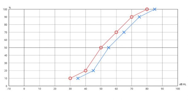 Audiometria Vocale